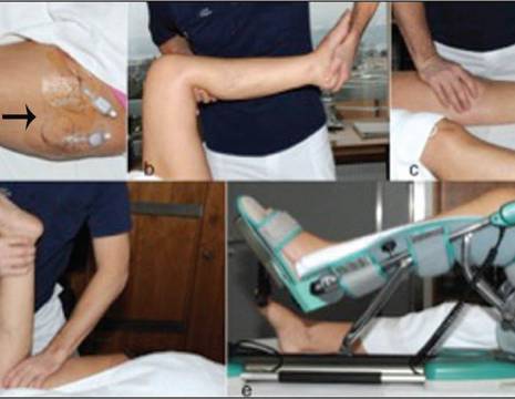 Cateterini perinervosi (freccia nera) per permettere mobilizzazione precoce di ginocchio con recente intervento di protesizzazione (freccia rossa) 1
