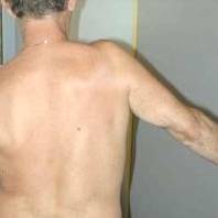 Spalla rigida