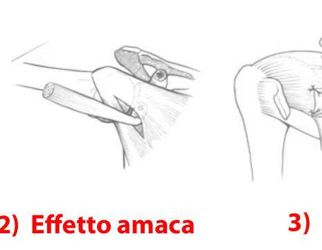 triplice effetto intervento di Latarjet.jpg 1